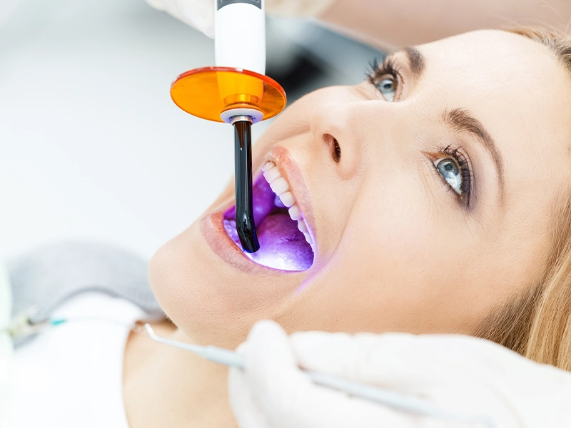 professional whitening kits