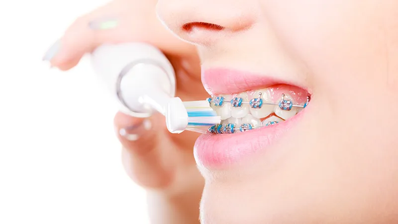brushing teeth with blue braces
