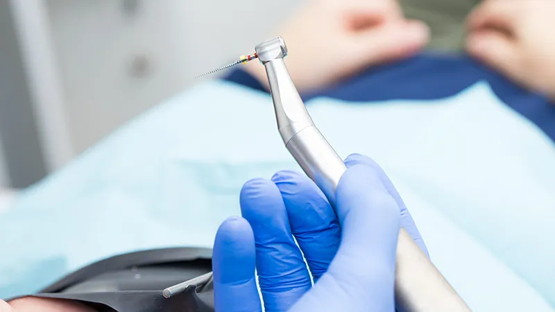 Root Canal Treatment