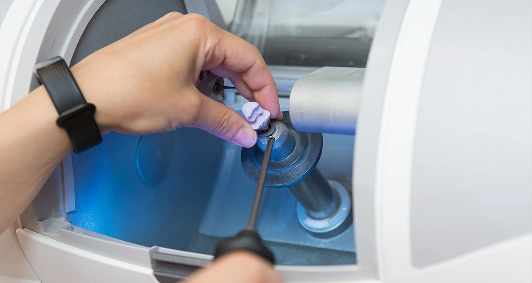 Rock-solid second chances with dental crowns